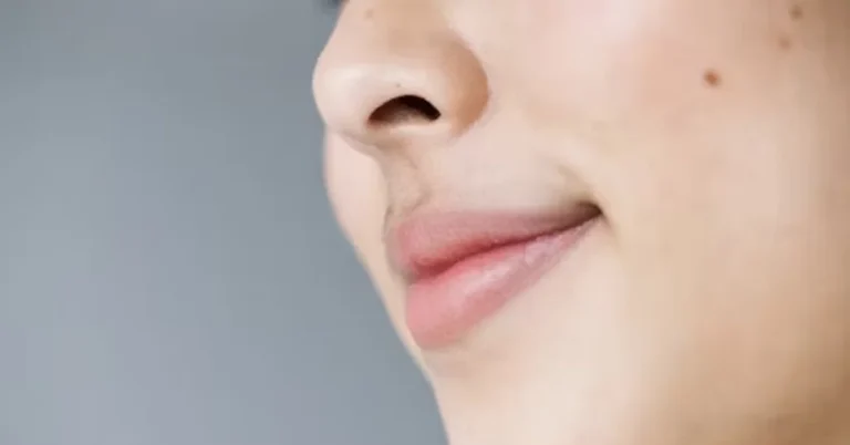 bump on nose bridge