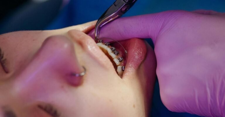 Orthodontic Treatment