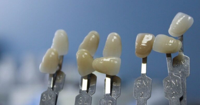 Orthodontic Care