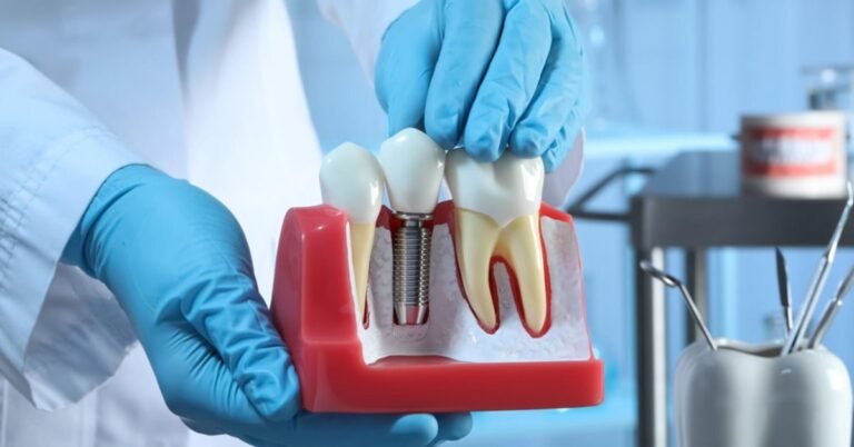 Dental Implant