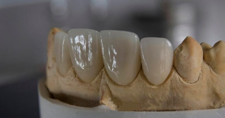 Sustainable Veneer Production